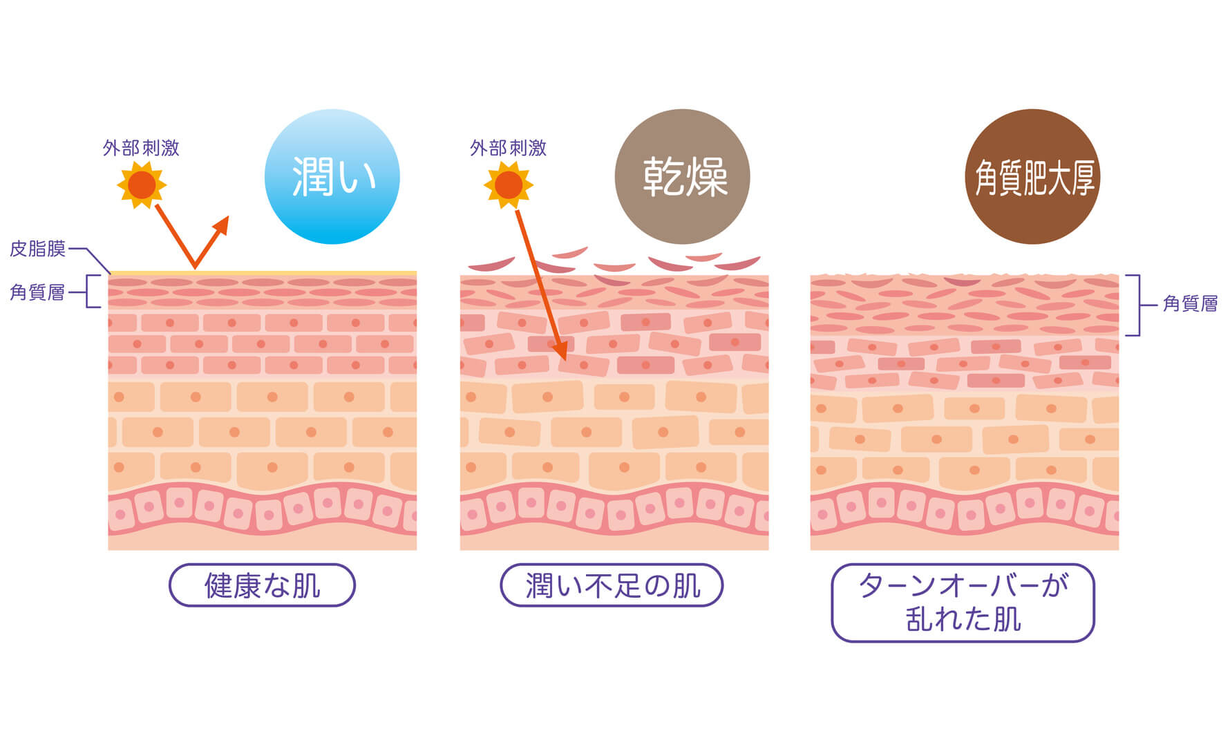 肌のうるおいと乾燥