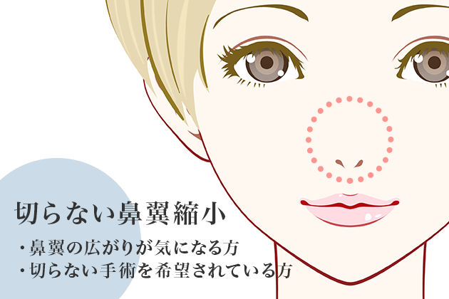 切らない鼻翼縮小(団子鼻の治療)