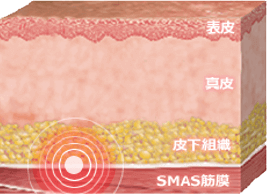 SMASへの働き