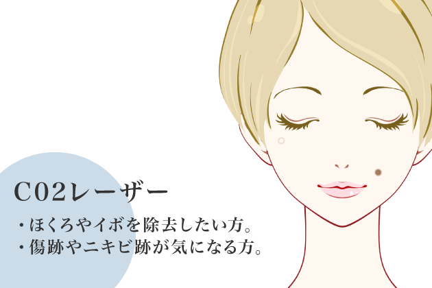 CO2レーザー